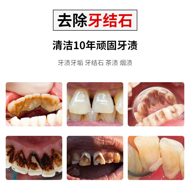 Electric Toothbrush Water Toothpick Dental Calculus Remover Teeth Care Tool Electric Teeth Cleaning Machine Ultrasonic