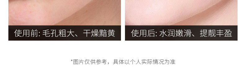 Wholesale Caviar Polypeptide Facial Skin Care Cosmetics Moisturizing Hydrating Facial Repair BB Cream Lotion Essence Cream Wholesale Caviar Polypeptide Facial Skin Care Cosmetics Moisturizing Hydrating Facial Repair BB Cream Lotion Essence Cream