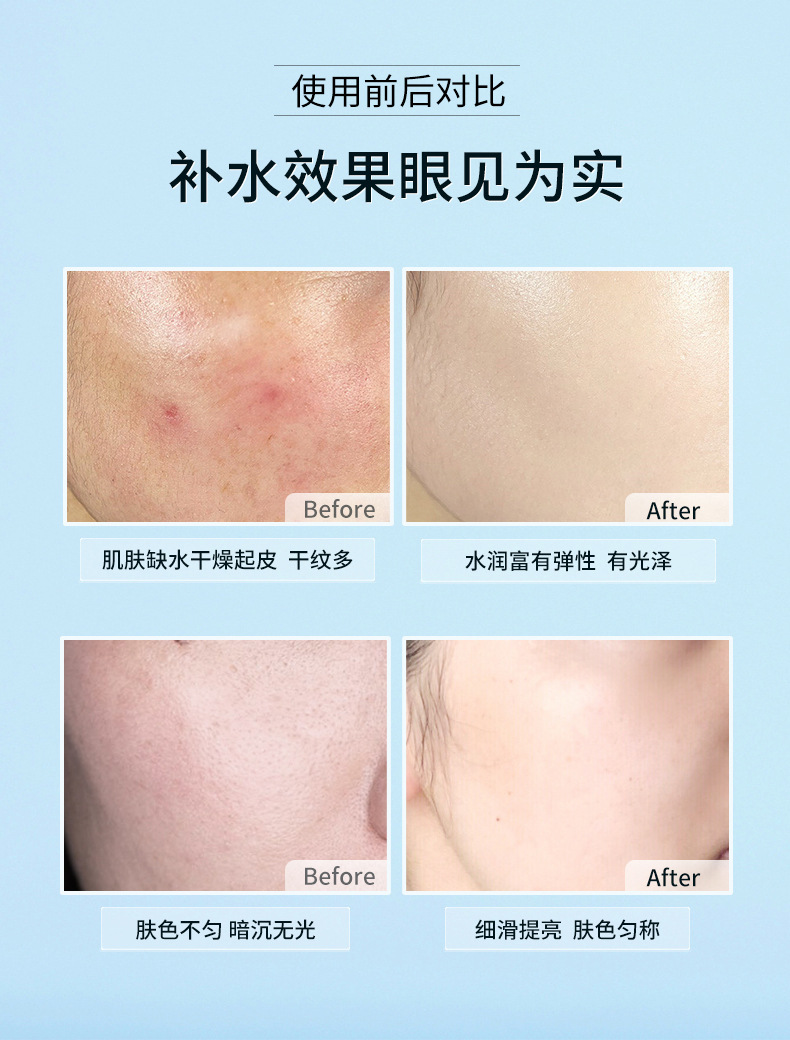 Bisutang Real Silk Fruit Mask Women Moisturizing Softening Skin Plant Mask Piece Wholesale