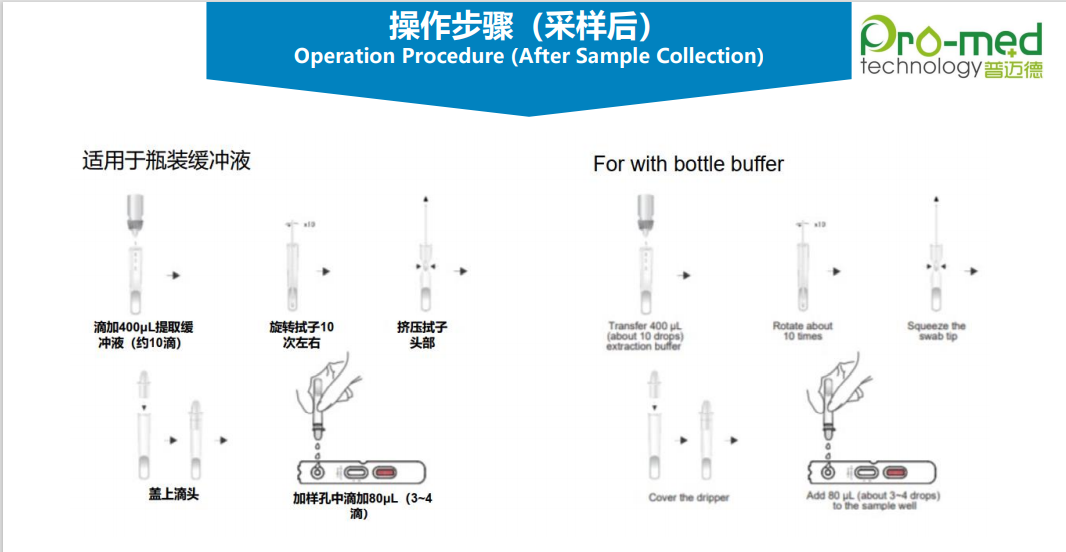 New Coronavirus (Covid-19) Antigen Detection Kit (Colloidal Gold Method) (Nasal Swab) Sampling New Coronavirus (Covid-19) Antigen Detection Kit (Colloidal Gold Method) (Nasal Swab) Sampling