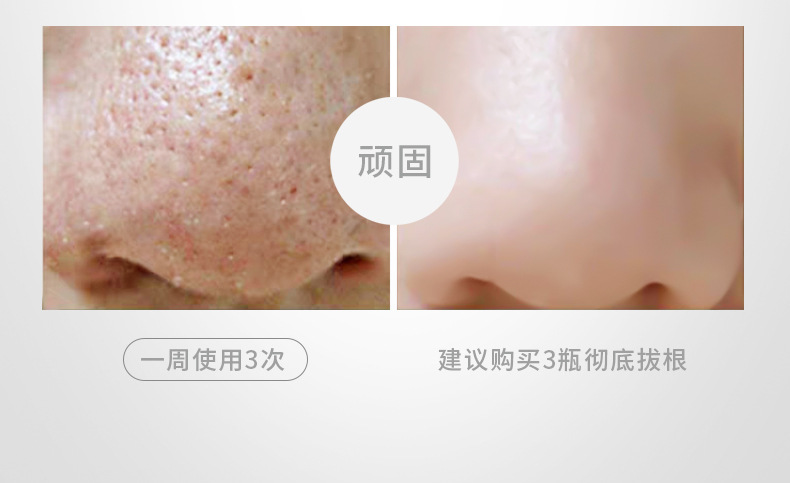 Cleansing Tearing Mask T District Care Acne Removing Blackhead Cutin Brightening Skin Hydrating Cleansing Nasal Membrane