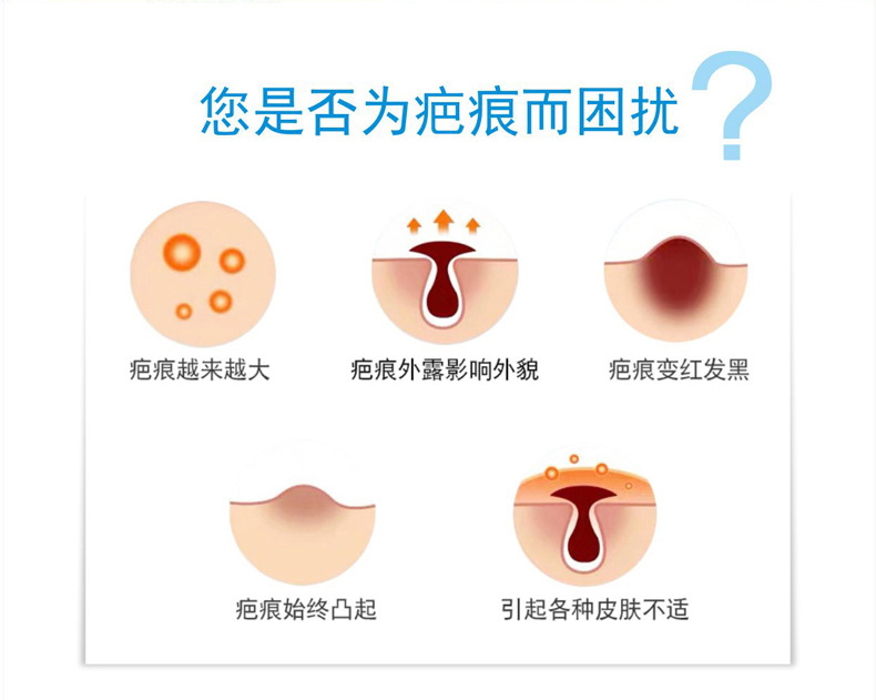 Medical Facial Acne Scar Acne Marks Children Trauma Scald Double Eyelid Surgery Hyperplasia Scar Medical Facial Acne Scar Acne Marks Children Trauma Scald Double Eyelid Surgery Hyperplasia Scar