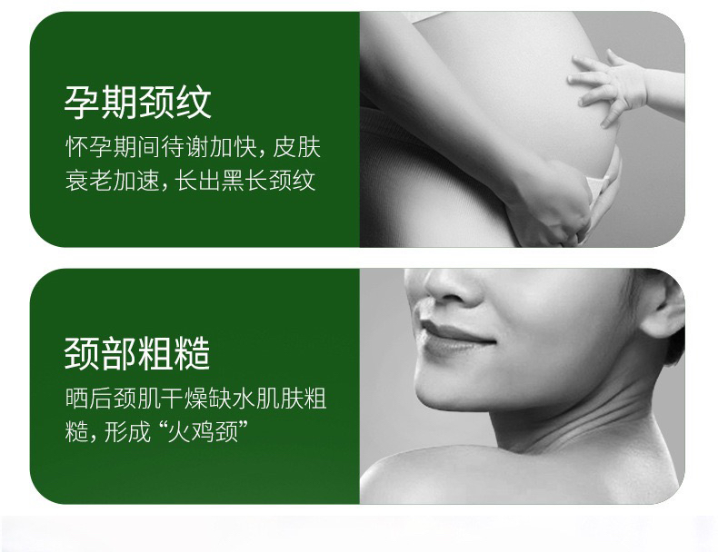 Baoma Baoma Mystery Foreign Trade Neck Cream Double-Roller Neck Neck Pattern Massage Cream 110G