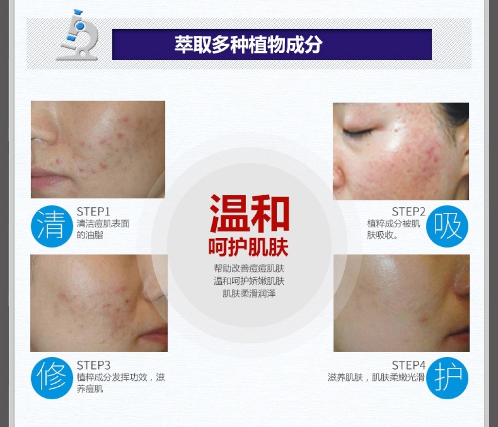 Bioaqua Facial Cream Acne Removing Shrink Pores Refreshing Oil Control Moisturizer Gentle Skin Care Facial Mask
