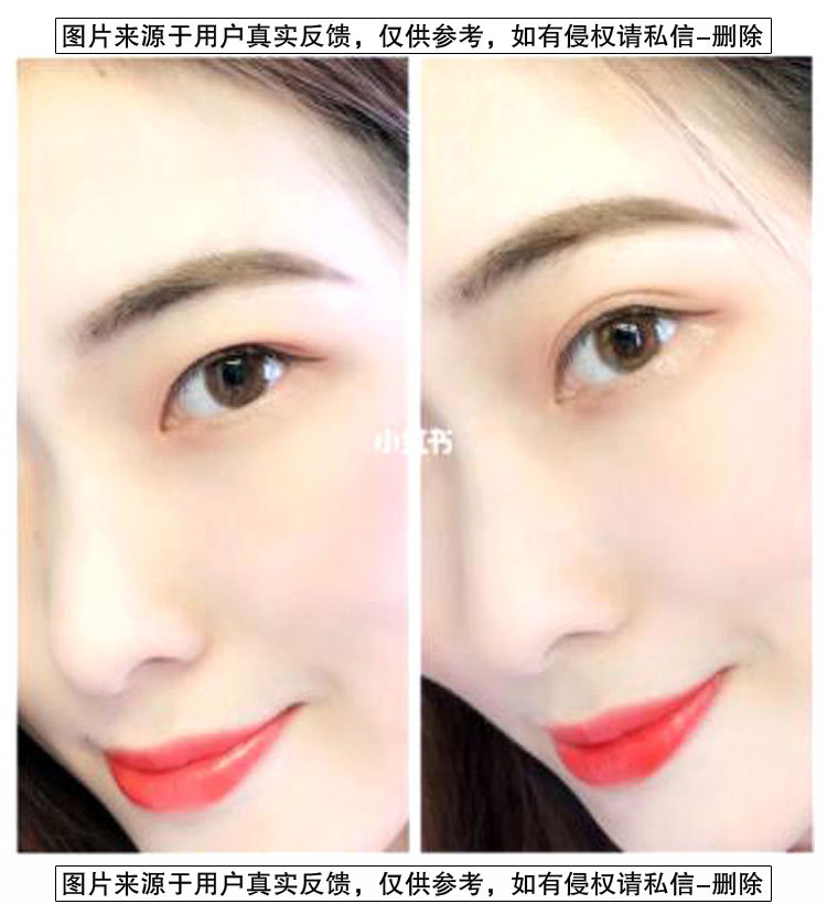 Lace Double Eyelid Stickers Olive Mesh Naturally Invisible Traceless Ventilation Skin Color Long-Lasting Double-Sided TikTok Same Style Wide Lace Double Eyelid Stickers Olive Mesh Naturally Invisible Traceless Ventilation Skin Color Long-Lasting Double-Sided TikTok Same Style Wide