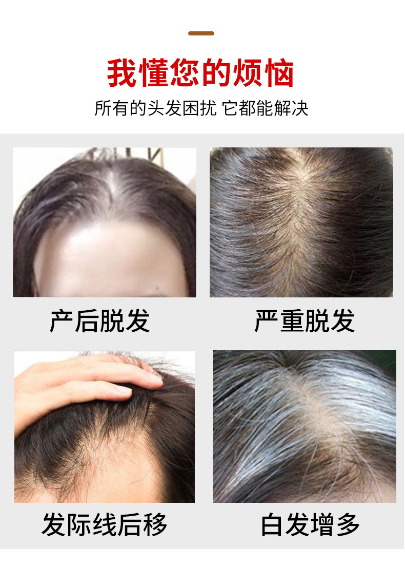 Wig Women's Long Hair Head Replacement Hair Extension Silk Mesh Bottom Human Hair Head Hairpiece Cover Gray Hair Wig Set Wig Women's Long Hair Head Replacement Hair Extension Silk Mesh Bottom Human Hair Head Hairpiece Cover Gray Hair Wig Set